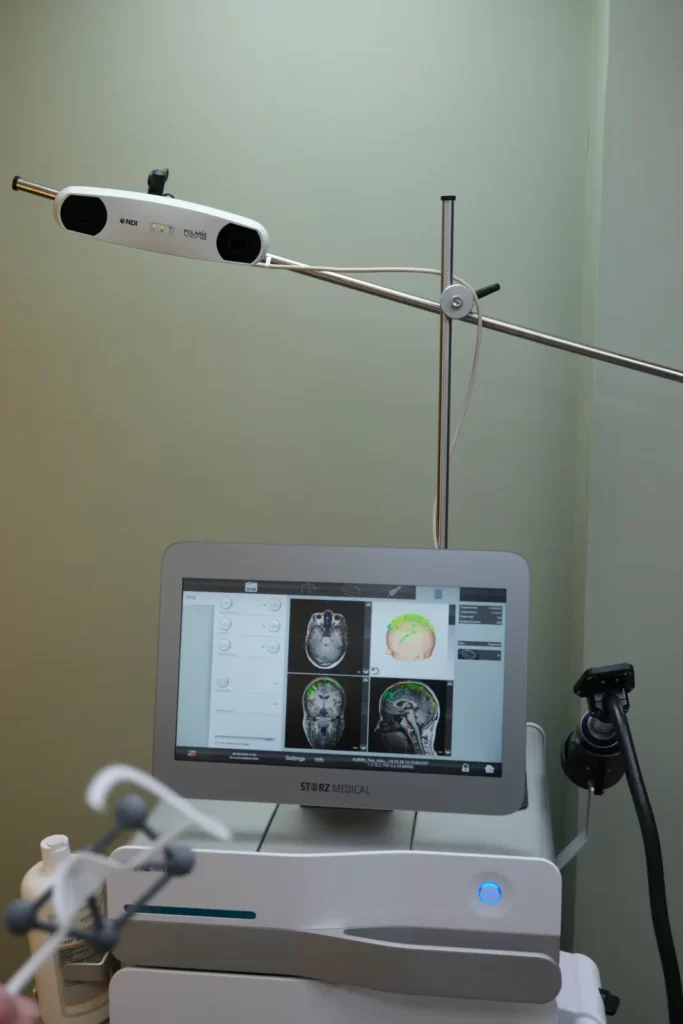 A brain MRI scan displayed on the TPS system for treatment planning