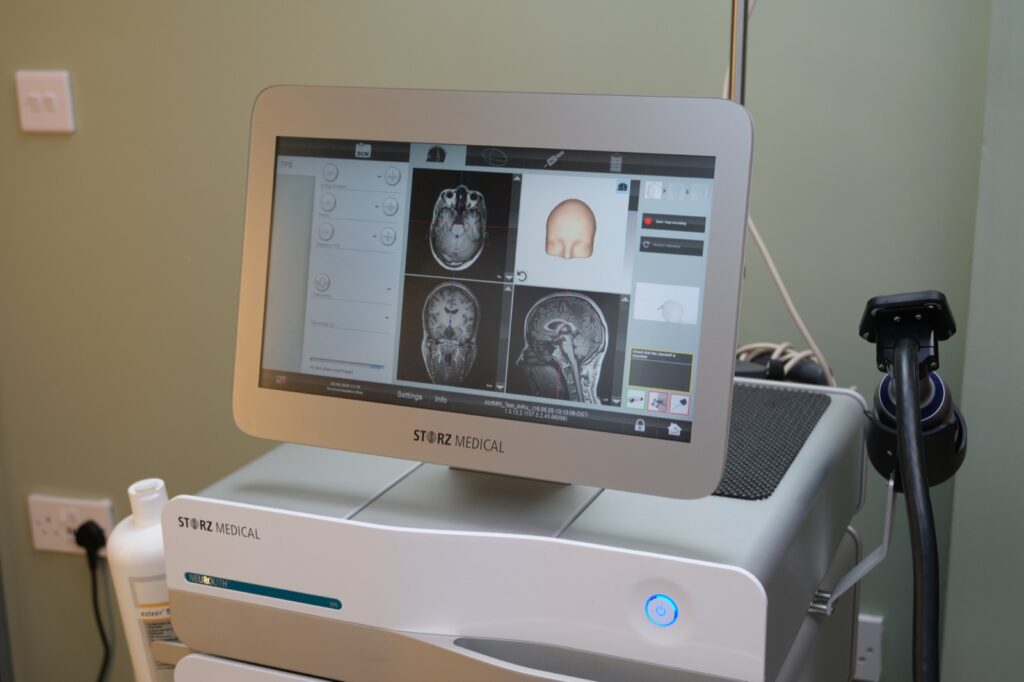 A TPS treatment system screen showing brain scan images